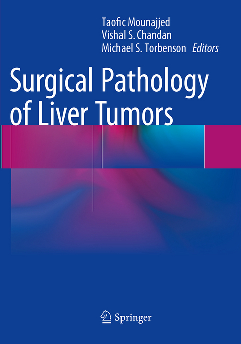 Surgical Pathology of Liver Tumors - 