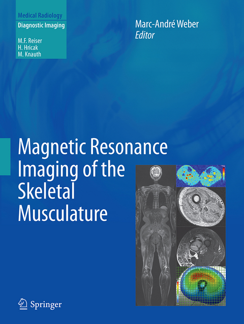 Magnetic Resonance Imaging of the Skeletal Musculature - 