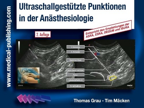 Ultraschallgestützte Punktionen in der Anästhesiologie - Thomas Grau; Tim Mäcken