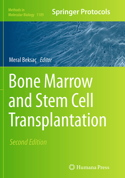 Bone Marrow and Stem Cell Transplantation - 