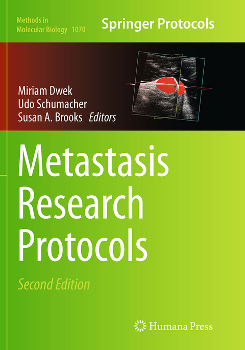 Metastasis Research Protocols - 