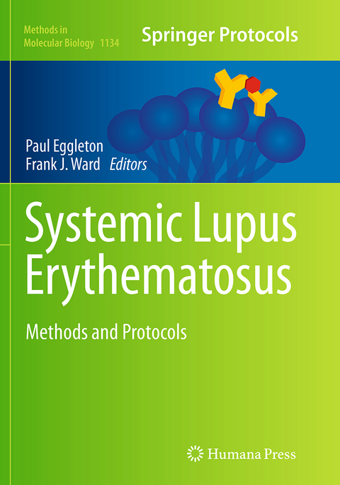 Systemic Lupus Erythematosus - 