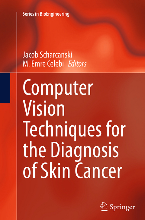 Computer Vision Techniques for the Diagnosis of Skin Cancer - 