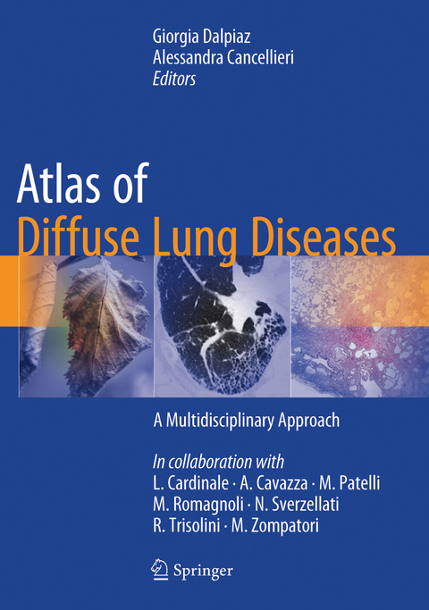 Atlas of Diffuse Lung Diseases - 