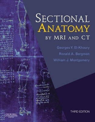 Sectional Anatomy by MRI and CT - Georges Y. El-Khoury, Ronald A. Bergman, William Joseph Montgomery, Brian F. Mullan, Alan Stolpen