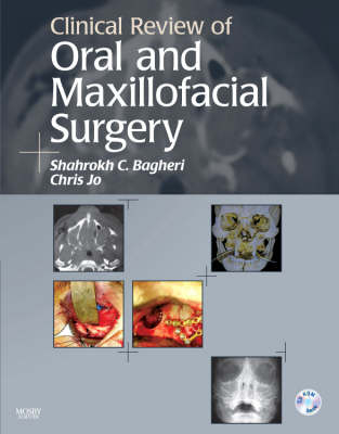 Clinical Review of Oral and Maxillofacial Surgery - Shahrokh C. Bagheri, Chris Jo