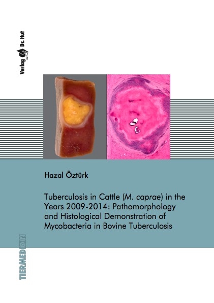 Tuberculosis in Cattle (M. caprae) in the Years 2009-2014: Pathomorphology and Histological Demonstration of Mycobacteria in Bovine Tuberculosis - Hazal Öztürk