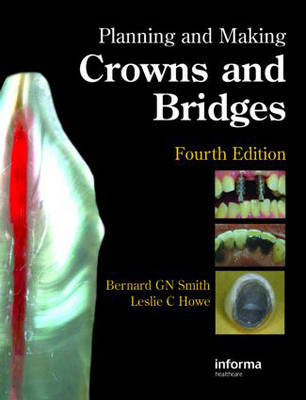 Planning and Making Crowns and Bridges - Bernard G.N. Smith, Leslie C. Howe