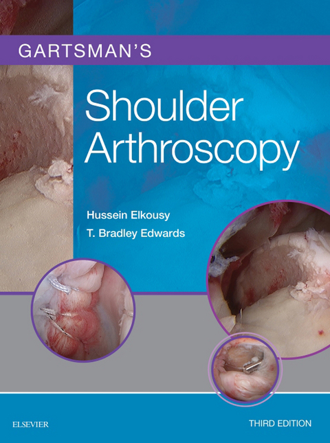 Gartsman's Shoulder Arthroscopy E-Book -  T. Bradley Edwards,  Hussein Elkousy