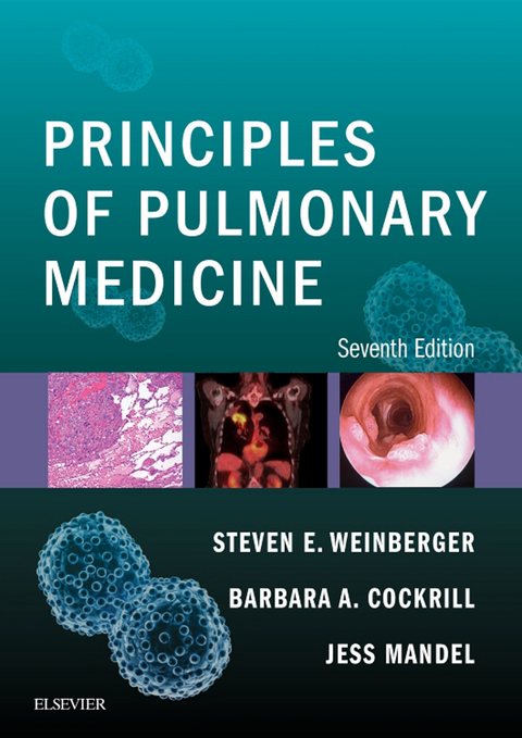 Principles of Pulmonary Medicine E-Book -  Barbara A. Cockrill,  Jess Mandel,  Steven E. Weinberger