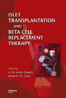 Islet Transplantation and Beta Cell Replacement Therapy - 