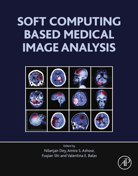 Soft Computing Based Medical Image Analysis -  Amira S. Ashour,  Valentina Emilia Balas,  Nilanjan Dey,  Fuquian Shi