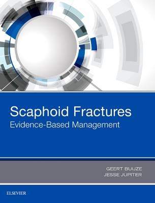 Scaphoid Fractures -  Geert Alexander Buijze,  Jesse B. Jupiter