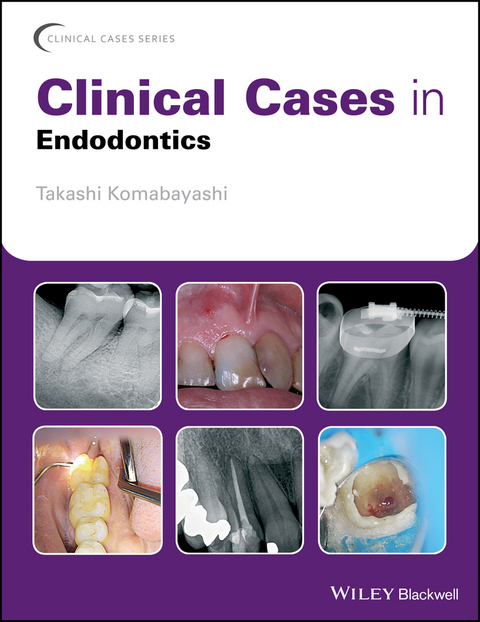 Clinical Cases in Endodontics - Takashi Komabayashi