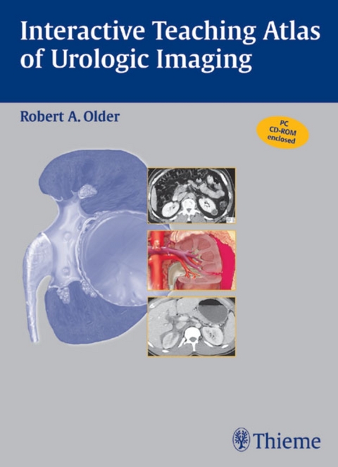 Interactive Teaching Atlas of Urologic Imaging, CD-ROM -  Older, Robert Older