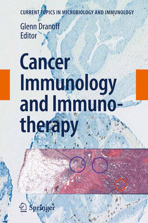 Cancer Immunology and Immunotherapy - 