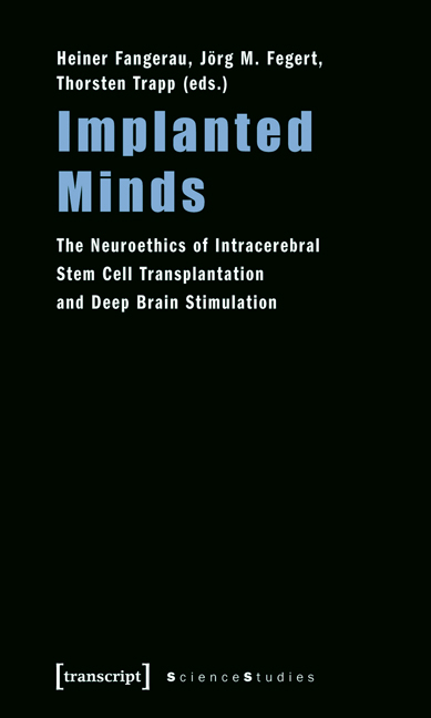 Implanted Minds - 