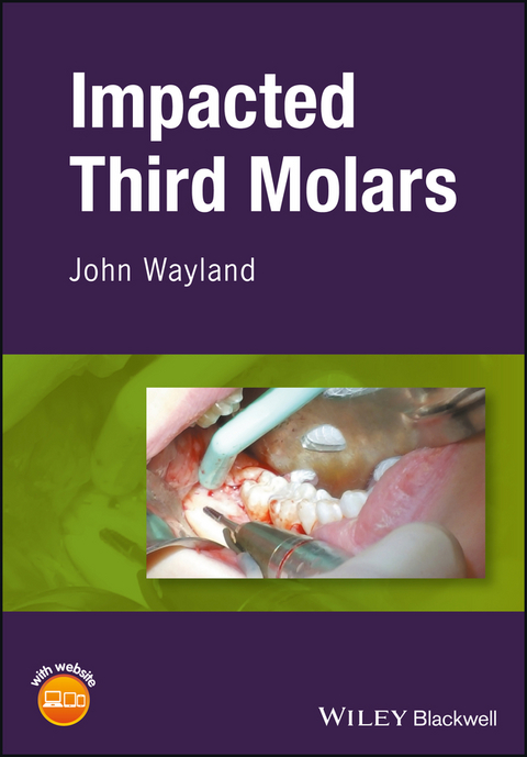 Impacted Third Molars - John Wayland