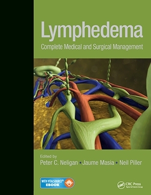 Lymphedema - 