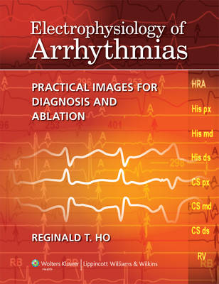 Electrophysiology of Arrhythmias - Reginald T. Ho