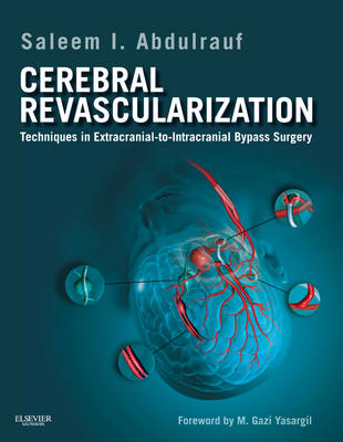 Cerebral Revascularization - Saleem I. Abdulrauf