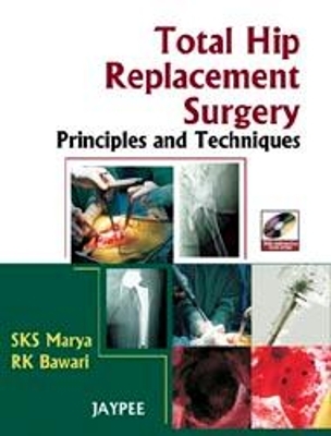 Total Hip Replacement Surgery - SKS Marya, RK Bawari