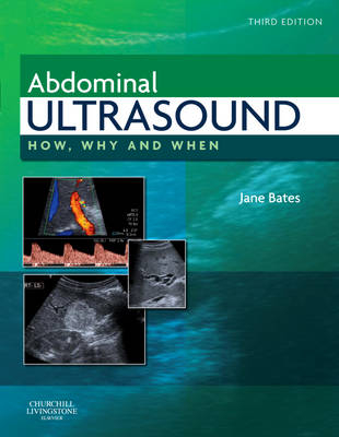 Abdominal Ultrasound - 