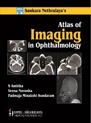 Atlas of Imaging in Ophthalmology - S Ambika, Veena Noronha, Padmaja Minakshi Sundaram