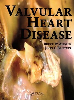 Valvular Heart Disease - Bruce Andrus, John Baldwin