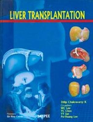 Liver Transplantation - Dilip K Chakravarty