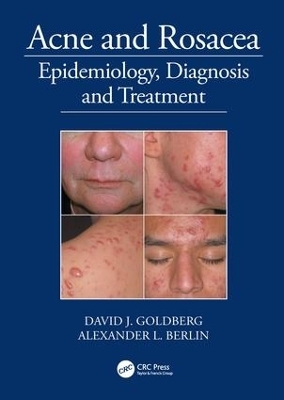 Acne and Rosacea - David Goldberg, Alexander Berlin