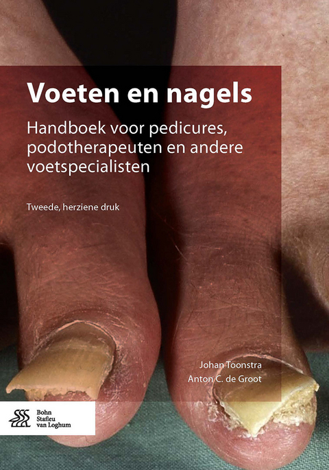 Voeten en nagels -  Johan Toonstra