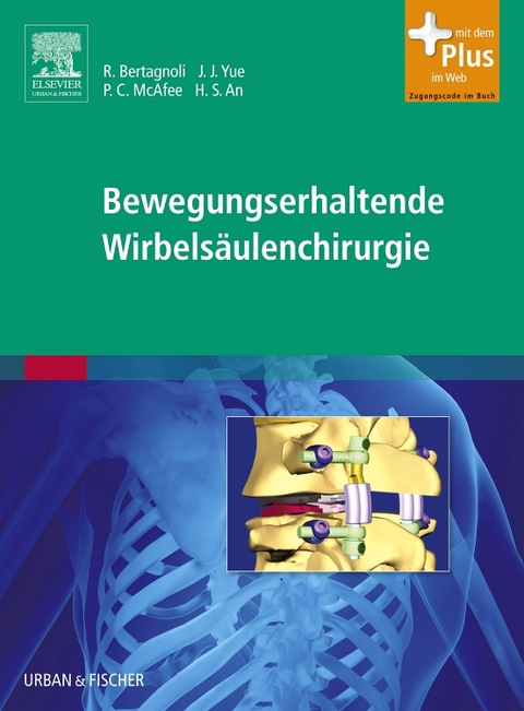 Bewegungserhaltende Wirbelsäulenchirurgie - 