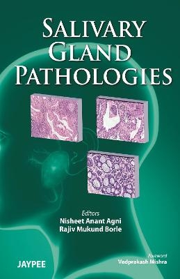 Salivary Gland Pathologies - Nisheet Anant Agni, Rajiv Mukund Borle