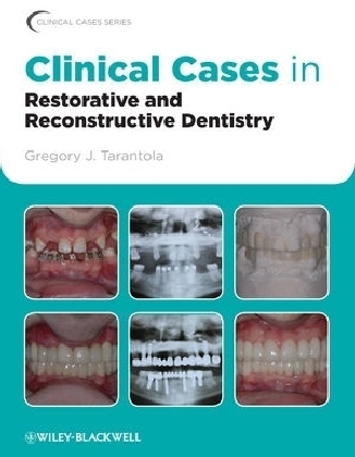 Clinical Cases in Restorative and Reconstructive Dentistry - Gregory J. Tarantola