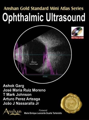 Mini Atlas of Ophthalmic Ultrasound - Dr. Ashesh Gunwantrao Wankhede