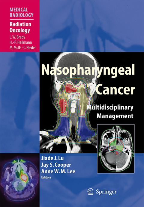 Nasopharyngeal Cancer - 