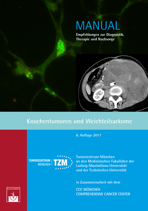 Knochentumoren und Weichteilsarkome - 