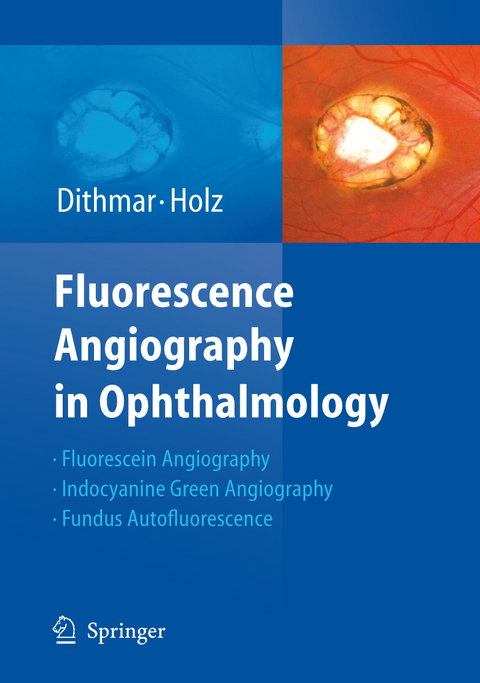 Fluorescence Angiography in Ophthalmology - Stefan Dithmar, Frank G. Holz