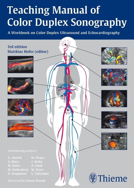 Teaching Manual of Color Duplex Sonography - Matthias Hofer,  MEDIDAK Publishing GmbH