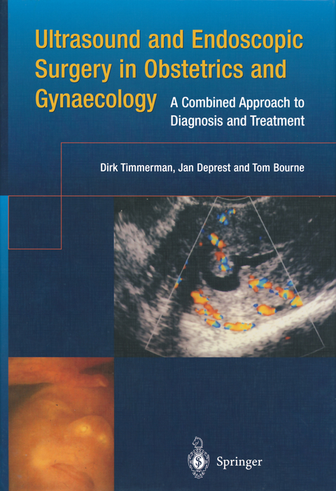 Ultrasound and Endoscopic Surgery in Obstetrics and Gynaecology - Dirk Timmerman, Jan Deprest, Tom Bourne