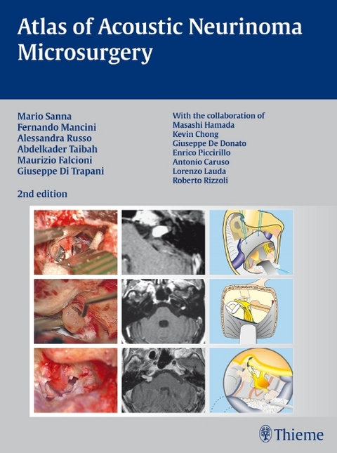 Atlas of Acoustic Neurinoma Microsurgery - Mario Sanna, Fernando Mancini, Alessandra Russo, Abdelkader Taibah, Maurizio Falcioni, Giuseppe Di Trapani