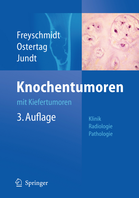 Knochentumoren mit Kiefertumoren - Jürgen Freyschmidt, Helmut Ostertag, Gernot Jundt