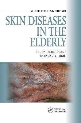 Skin Diseases in the Elderly - Colby Evans, Whitney High