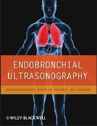 Endobronchial Ultrasonography - 