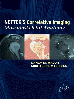 Netter's Correlative Imaging: Musculoskeletal Anatomy - Nancy M. Major, Michael D. Malinzak