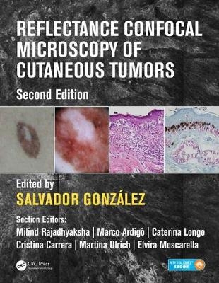 Reflectance Confocal Microscopy of Cutaneous Tumors - 