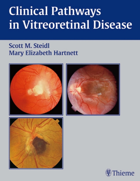 Clinical Pathways In Vitreoretinal Disease - 