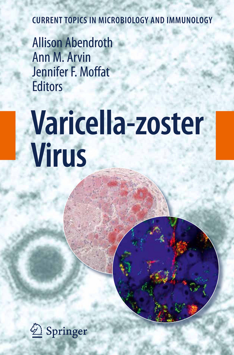 Varicella-zoster Virus - 