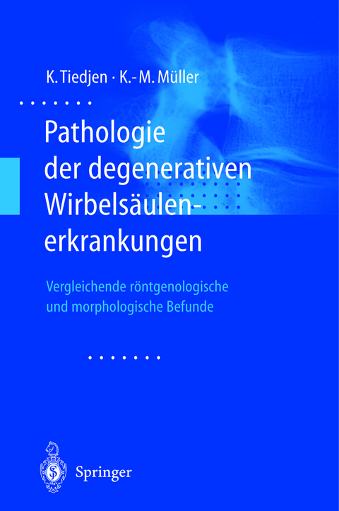 Pathologie der degenerativen Wirbelsäulenerkrankungen - Kay Tiedjen, Klaus-Michael Müller